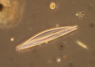 Plankton - zooplantkon, phytoplankton