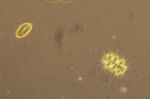 Plankton - zooplantkon, phytoplankton