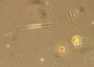 Plankton - zooplantkon, phytoplankton